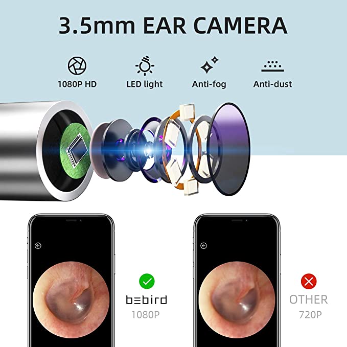 New Ear Wax Removal | Ears Cleaner | Wireless Wfi Ear Camera